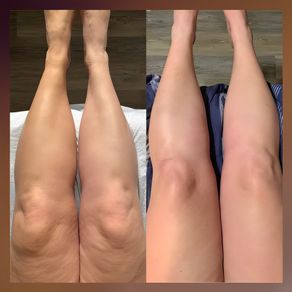 Anti-Cellulite Massage Oil™