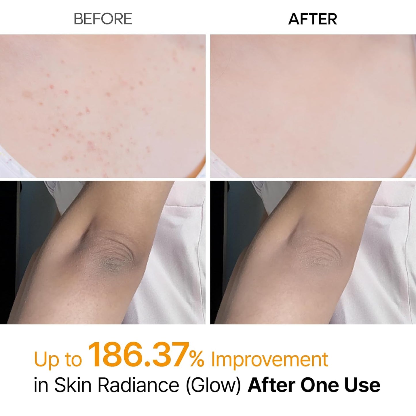 Dr. Melaxin BP Peelshot | 1-Minute Korean Brightening & Resurfacing Spray