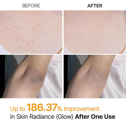 Dr. Melaxin BP Peelshot | 1-Minute Korean Brightening & Resurfacing Spray